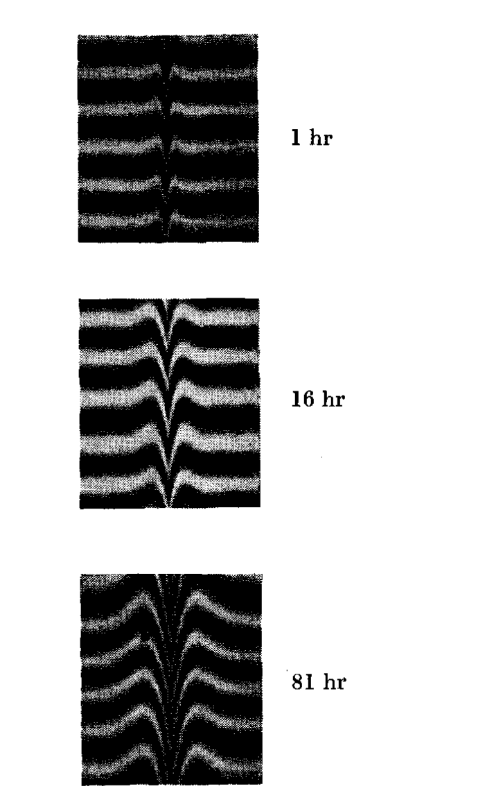 Interference micrographs showing a copper grain-boundary groove after 1, 16, and 81 hours at 930 degrees Celsius